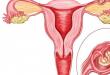 Показывает ли тест внематочную беременность, и как трактовать результат?